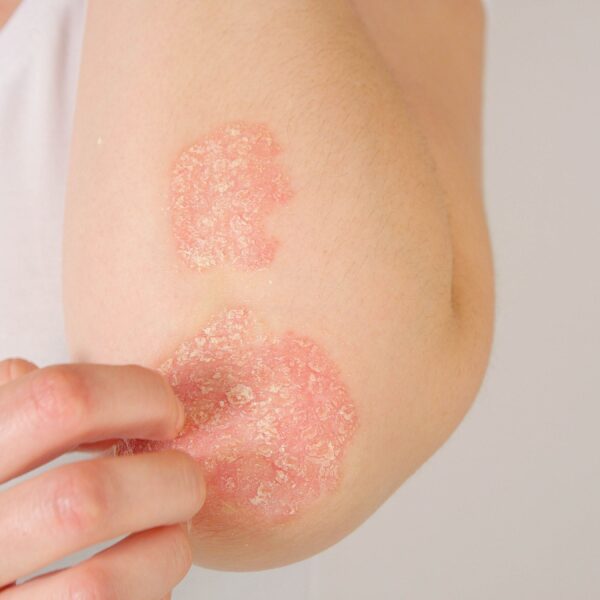 Crema protectora de Caléndula 50ml - Imagen 2